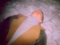 twenty two shots in the head....