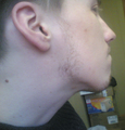 The beard is out there